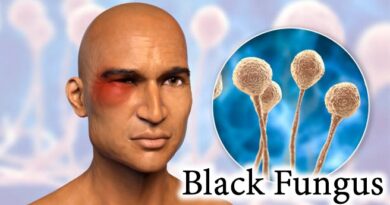 ब्लैक फंगस के लक्षण और आयुर्वेदिक उपाय : Black Fungus in Hindi